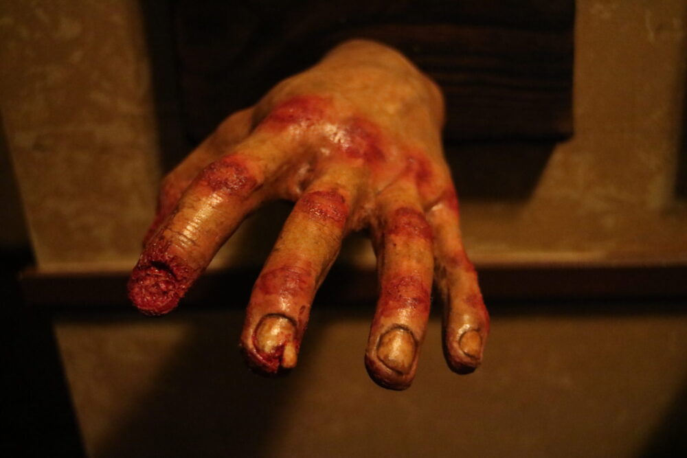 a detailed model of a severed, decaying hand, possibly used for educational or display purposes in a historical or horror-themed setting